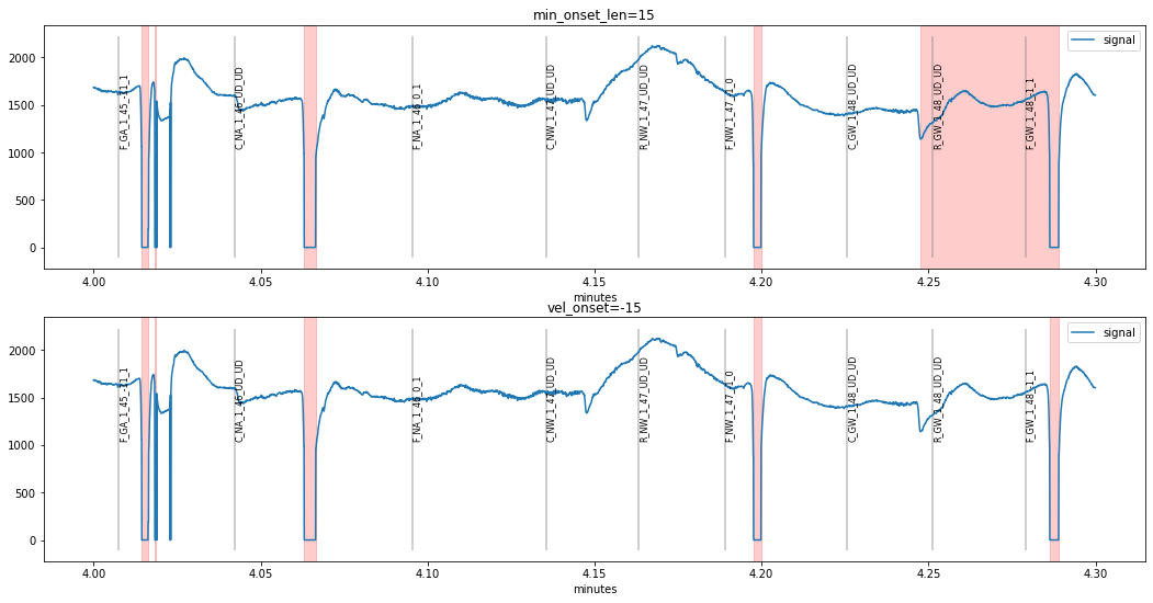 blink-preprocessing-pypillometry-documentation